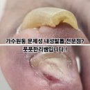 네일밀랜드 | 가수원동 문제성 내성발톱? 전문점에서 올바른 케어 받으세요.~