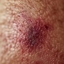 크림약국 이미지