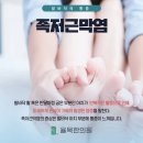 청주 족저근막염 체형 불균형까지 잡는 한의원 가이드