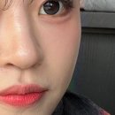 세븐일레븐 광주첨단병원점 | 광주스킨부스터 고민하다 다녀온 첨단피부과, 광주에버클볼륨