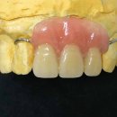 이룸 치과기공소 이미지