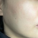 혜화산부인과의원 | 명동역 피부과 전문 병원 좋아요 추천 List 6곳