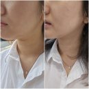 용신69 | 용산 피부관리 아프지않은 윤곽관리 스테디윤 에스테틱 방문후기