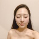 더블유더블유역삼본점 | 천호역 피부관리 : 금손명가 (솔직후기)