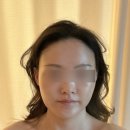 바른몸애 | [방배피부관리] 바른몸애 방배점 얼굴윤곽관리 후기