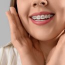 기장치아교정 할 때 발치를 꼭 해야 하나요?