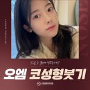 오엠성형외과의원 네이버블로그