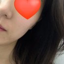 몰디브태닝은평 | 연신내 화이트태닝 후기 몰디브태닝 은평점
