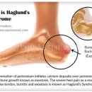 본케어 운동센터 이미지