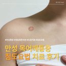 명한의원 | 만성 목어깨통증 청담동 한의원 침도요법후기 목디스크 도침치료