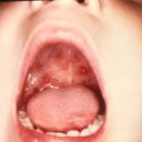 소아랑한의원 이미지