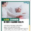 넘어져 다친 고관절 골절,고관절인공관절수술이 필요하다!! 이미지