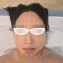 힐링Fit영양 | 구디피부관리실 디오라 에스테틱&헤드스파, 1:1 맞춤 Air-fit 윤곽관리로 무너진 탄력 끌어올려