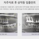 미소하나치과의원 네이버블로그