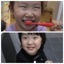 이 편한 우리 아이 구강 관리법 | 🦷 영유아구강검진, 5살 아이 크라운 치료 후기