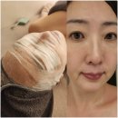 빈센트 | [안양 피부관리] 빈센트 에스테틱 물톡스 후기! 1:1 맞춤 케어와 첫 방문 3만원의 행복