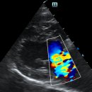 마음을 읽어주는 마음동물병원 | ★ 강아지 숨이 가쁘다면?★ 강아지 심장병, 폐부종/마음을 읽어주는 마음동물병원