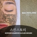 더스킨스토리 | <내돈내산> 스트레스로 지친 피부, 스킨스토리 바이오 필링 관리 후기