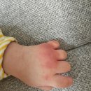 김이태소아과 이미지