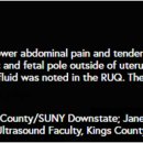 Ectopic pregnancy_30s female 이미지