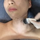 군산댁 | 군산 피부관리 보금뷰티 후기: 리프팅·잡티·피코토닝 올인원 관리 추천