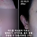유스앤영서울뷰의원 네이버블로그