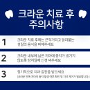 상아치과재료 이미지