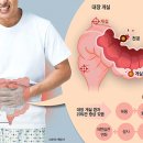 대장 티스토리