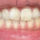 슈어란트치과의원 이미지