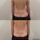 신부 관리 :: 부천 '무니크 에어바디' 에너지 테라피 후기 (내돈내산)