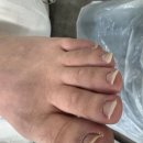 레푸스앤두두네일