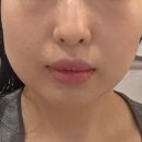 5553 | [잠실새내] 오늘뷰티｜두피부터 끌어올리는 풀페이스 리프팅 관리 후기