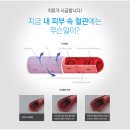 붉은 내 얼굴, 안면홍조 치료법 ! 엑셀V로 극복하자 이미지