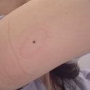 경화헬스 | 내 정보는 어차피 털린다, 그럼 내가 직접 팔기로 했다 — 삼성서울병원 정밀헬스 임상 참여 후기