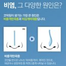 코코성형외과의원 네이버블로그