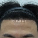 모먼트의원 이미지