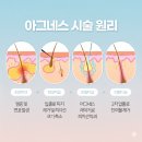 아그네스 | 아그네스 레이저 후기 내돈내산 트러블 피지선 관리 통증 효과