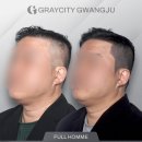 흥미 헤어라인