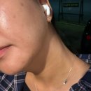 마두하나약국 | [고양 백석] 일산 피부 관리 여드름 압출 &lt;솔에스테틱 일산점&gt;