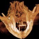 으뜸덴탈 이미지