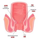 편안한약국 | 치핵 연고 추천 받고 약국 치핵 약 사용한 후기