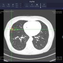 주식회사메드솔루션 이미지