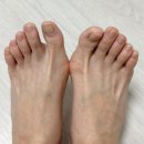 포세 | 연수샤워기 추천 포세이온 자화이온수 샤워기 3주 사용 후기, 피부 가려움증 개선 효과