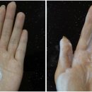 미소피부 이미지