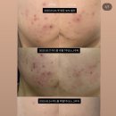 둔산중로-38 | 플로럴스킨 둔산점 슬림팔뚝 후기｜웨딩촬영 전 필수관리 싸이블로