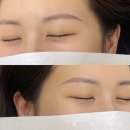 키닛브로우바 | 대구 눈썹 컨설팅 잔흔 커버 성공! 인생 눈썹 찾고 온 '키닛브로우바' 솔직후기