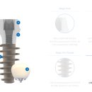 이노바이오써지 이미지