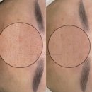 세멘잘크림으로 목주름 팔자주름 사용 후기