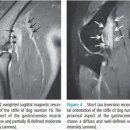 clinical, radiographic, and magnetic resonace imaging findings of gastrocnemius musculotendinopathy in various dog breeds 이미지