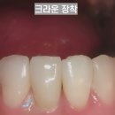 홈플란트치과의원 이미지